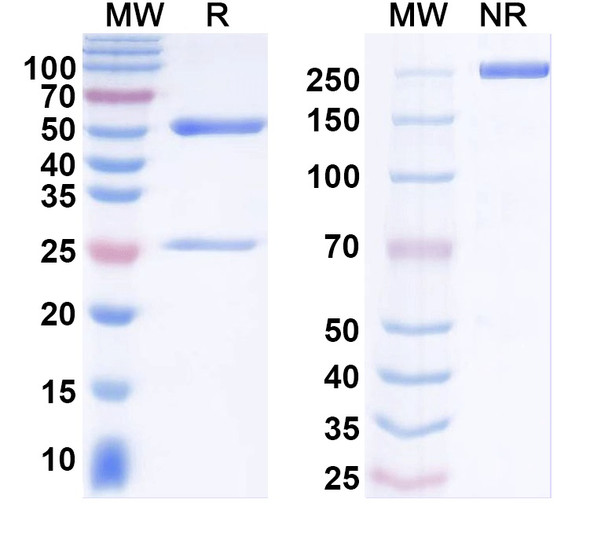 Anti-Ankyrin-G Recombinant Monoclonal Antibody (N106/20) - SDS-PAGE