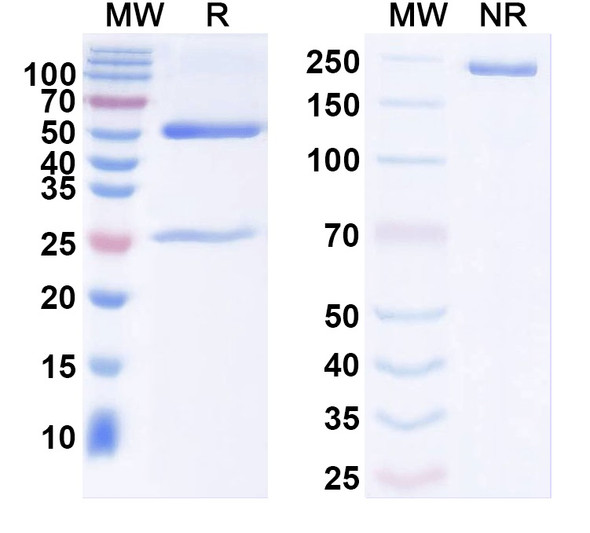Anti-Ankyrin-G Recombinant Monoclonal Antibody (N106/56) - SDS-PAGE