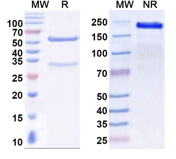 Anti-Tiam1 Recombinant Monoclonal Antibody (L130/1) - SDS-PAGE