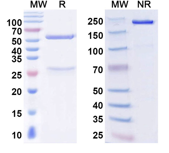 Anti-Tiam1 Recombinant Monoclonal Antibody (L130/119) - SDS-PAGE