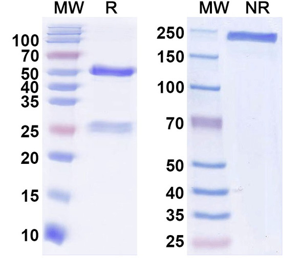 Anti-TDP43 Recombinant Monoclonal Antibody (N339/33) - SDS-PAGE