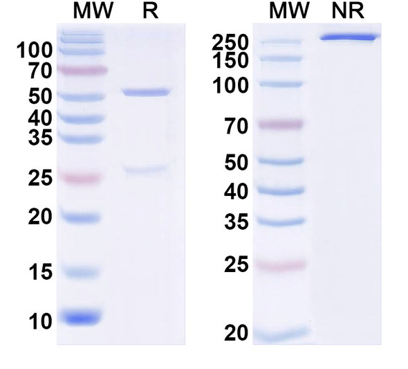 Anti-JIP-2/IB-2 Recombinant Monoclonal Antibody (N135/23) - SDS-PAGE