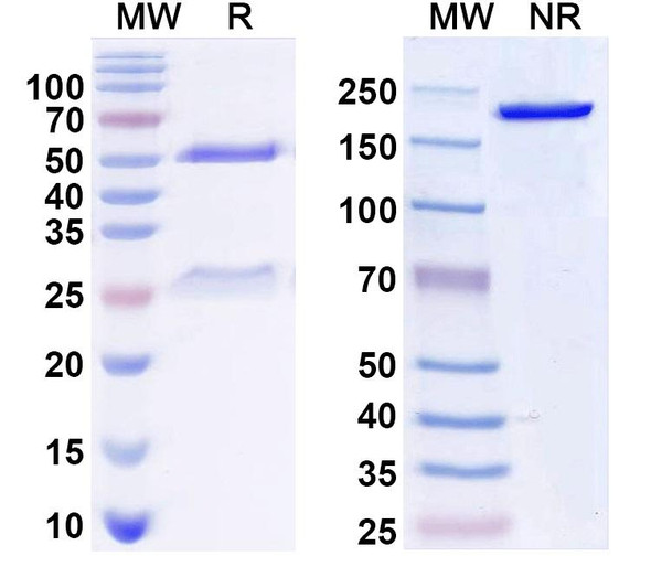 Anti-KCC2 Recombinant Monoclonal Antibody (N1/12) - SDS-PAGE