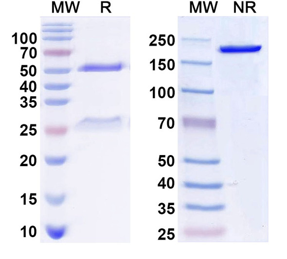 Anti-KCC2 Recombinant Monoclonal Antibody (N1/55) - SDS-PAGE