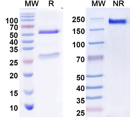 Anti-PEX6 Recombinant Monoclonal Antibody (N233/22) - SDS-PAGE