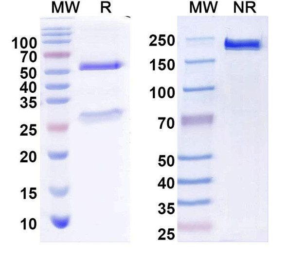 Anti-PEX6 Recombinant Monoclonal Antibody (N233/22) - SDS-PAGE