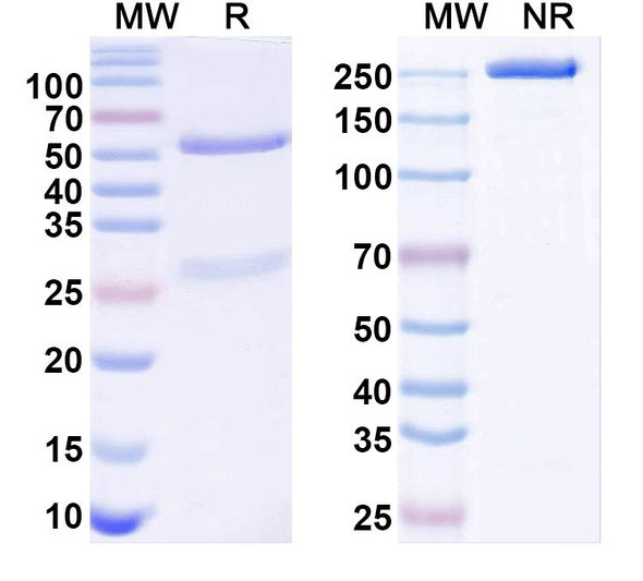 Anti-Cav1.2 Ca2+ channel Recombinant Monoclonal Antibody (N263/53) - SDS-PAGE