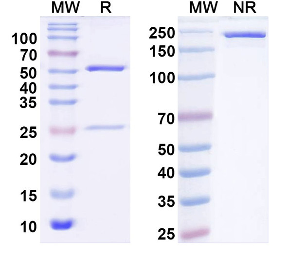 Anti-WRN Recombinant Monoclonal Antibody (N428/12) - SDS-PAGE