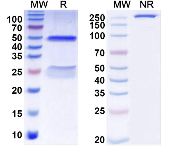 Anti-Kir6.2 K+ channel Recombinant Monoclonal Antibody (N363/58) - SDS-PAGE