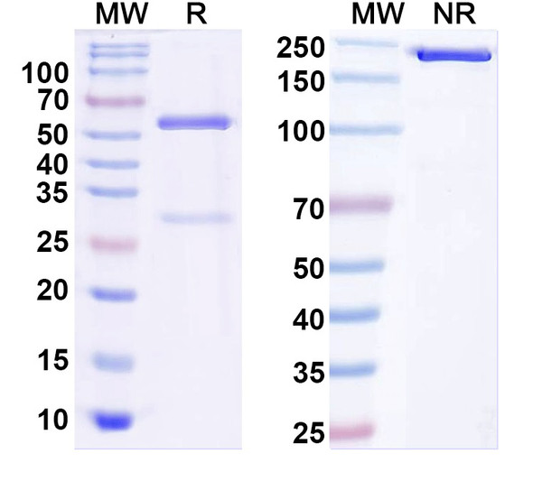 Anti-Kir6.2 K+ channel Recombinant Monoclonal Antibody (N363/95) - SDS-PAGE