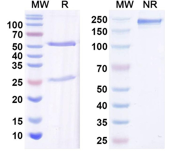 Anti-Kvbeta2 K+ channel Recombinant Monoclonal Antibody (K17/70) - SDS-PAGE