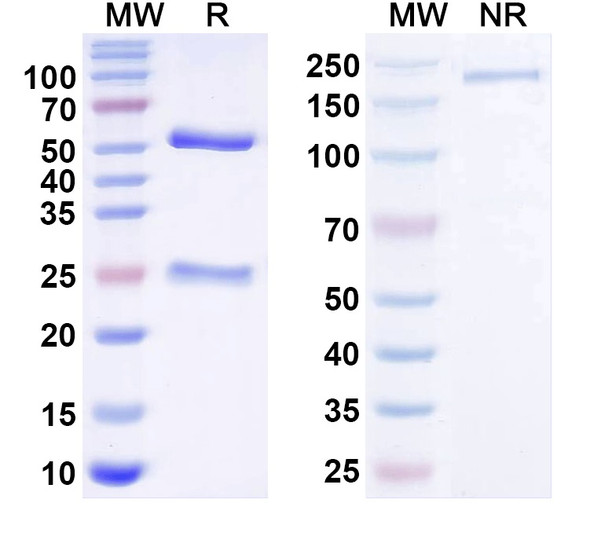 Anti-PSD-93/Chapsyn-110 Recombinant Monoclonal Antibody (N18/28) - SDS-PAGE