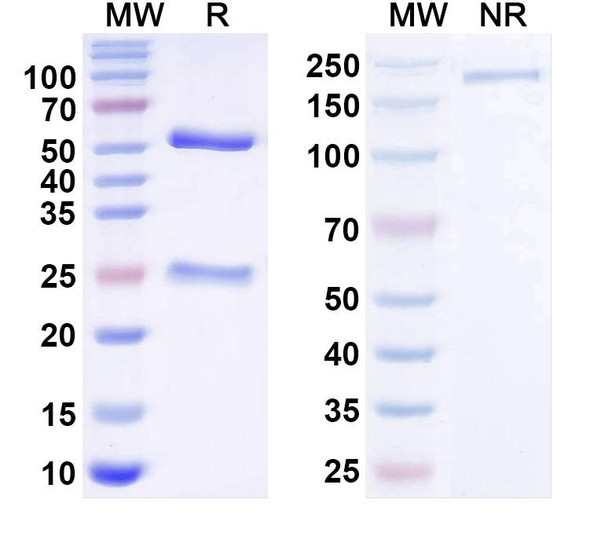 Anti-PSD-93/Chapsyn-110 Recombinant Monoclonal Antibody (N18/28) - SDS-PAGE