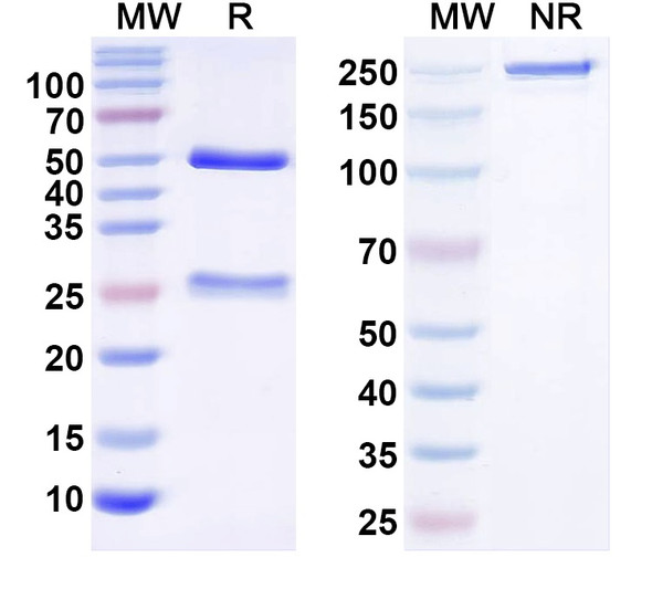 Anti-Kir6.1 K+ channel Recombinant Monoclonal Antibody (N366/12) - SDS-PAGE