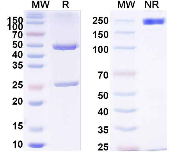 Anti-Nav1.1 Na+ channel Recombinant Monoclonal Antibody (K74/71) - SDS-PAGE