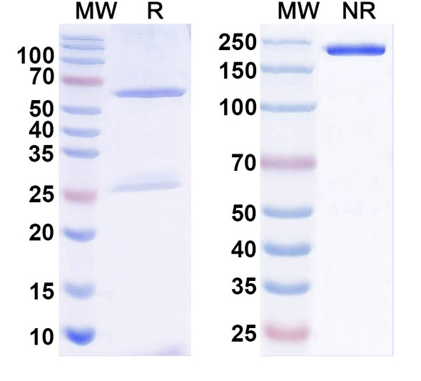 Anti-VAChT Recombinant Monoclonal Antibody (N6/45) - SDS-PAGE