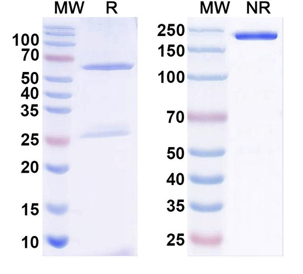 Anti-Frataxin Recombinant Monoclonal Antibody (N191/6) - SDS-PAGE
