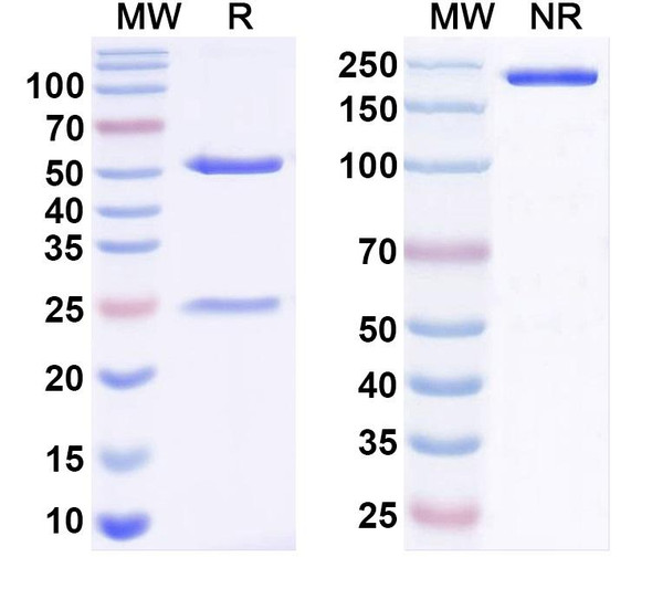 Anti-Frataxin Recombinant Monoclonal Antibody (N191/7) - SDS-PAGE