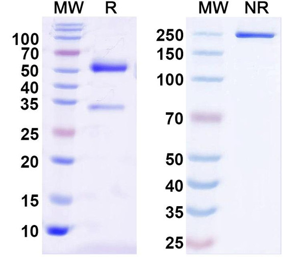Anti-SMN2 Recombinant Monoclonal Antibody (N179/6) - SDS-PAGE