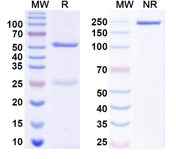Anti-LRRK2/Dardarin Recombinant Monoclonal Antibody (8G10) - SDS-PAGE