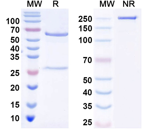 Anti-OCRL/INPP5b Recombinant Monoclonal Antibody (N166A/26) - SDS-PAGE
