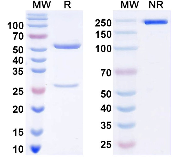 Anti-KChIP4 K+ channel Recombinant Monoclonal Antibody (N423/23) - SDS-PAGE
