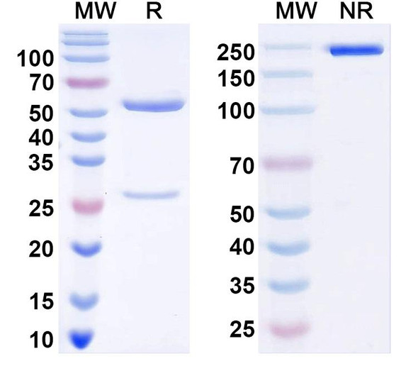 Anti-KChIP4 K+ channel Recombinant Monoclonal Antibody (N423/23) - SDS-PAGE