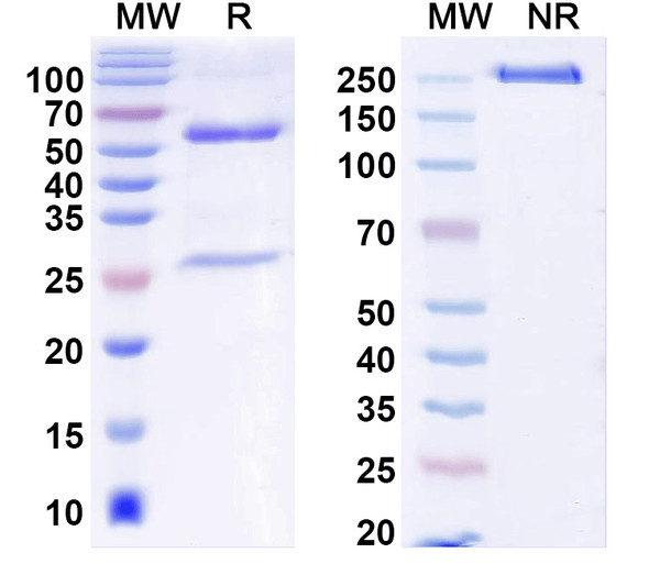 Anti-ANO5/TMEM16E Recombinant Monoclonal Antibody (N421A/36) - SDS-PAGE