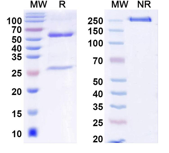 Anti-ANO5/TMEM16E Recombinant Monoclonal Antibody (N421A/36) - SDS-PAGE