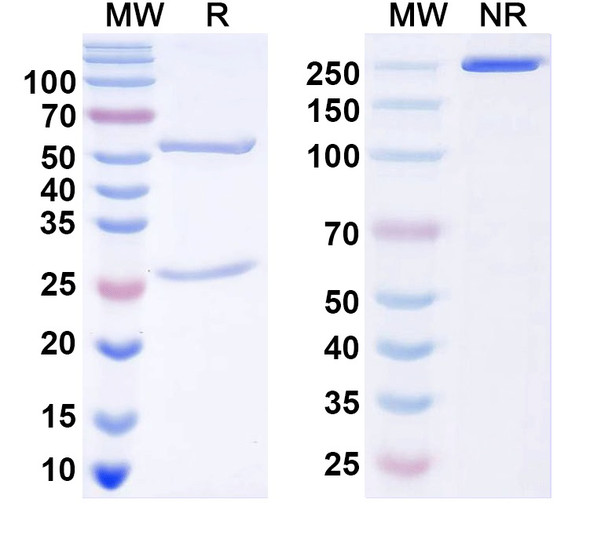 Anti-ANO5/TMEM16E Recombinant Monoclonal Antibody (N421A/50) - SDS-PAGE