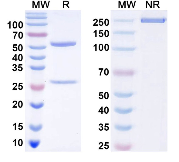Anti-TrpM8 Recombinant Monoclonal Antibody (N198/17) - SDS-PAGE