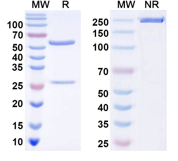 Anti-TRESK K+ channel Recombinant Monoclonal Antibody (N467/56) - SDS-PAGE