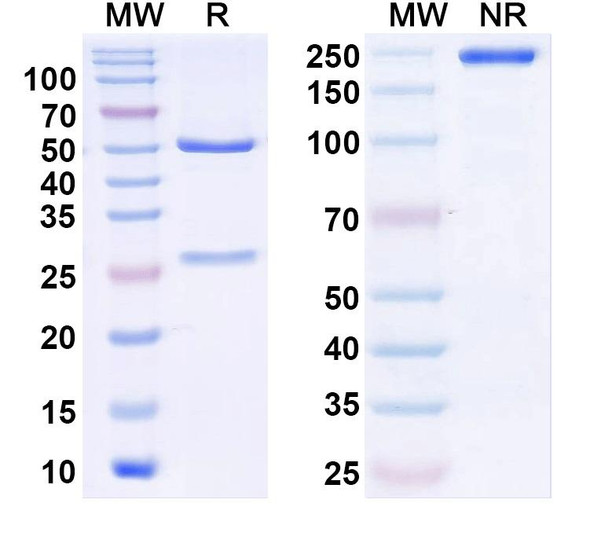 Anti-BKbeta4 K+ channel Recombinant Monoclonal Antibody (N42/37) - SDS-PAGE