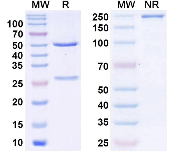 Anti-AMIGO-1 Recombinant Monoclonal Antibody (L86/36) - SDS-PAGE