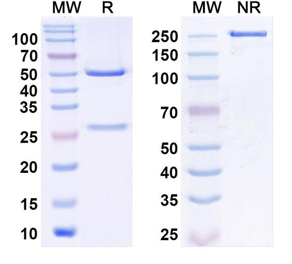 Anti-SLC13A5/NaCT Recombinant Monoclonal Antibody (N488/25) - SDS-PAGE