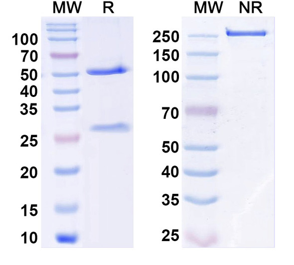 Anti-Synaptotagmin-12 Recombinant Monoclonal Antibody (N277/44) - SDS-PAGE