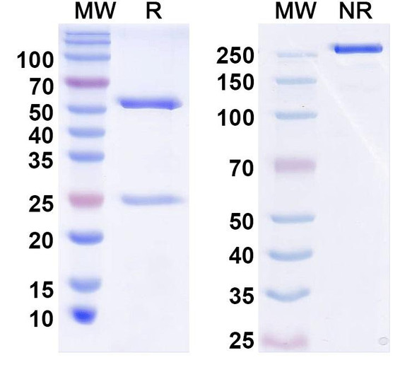 Anti-Rem2 Recombinant Monoclonal Antibody (N324/29) - SDS-PAGE