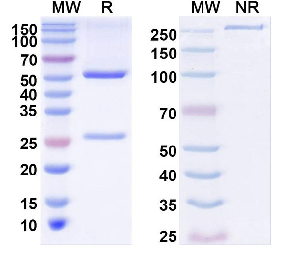 Anti-NALCN Recombinant Monoclonal Antibody (N185/7) - SDS-PAGE