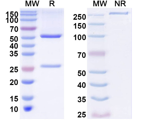 Anti-Kirrel3 Recombinant Monoclonal Antibody (N321C/49) - SDS-PAGE