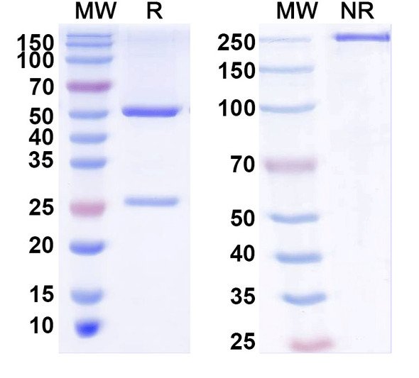 Anti-FBXL14 Recombinant Monoclonal Antibody (L97A/35) - SDS-PAGE
