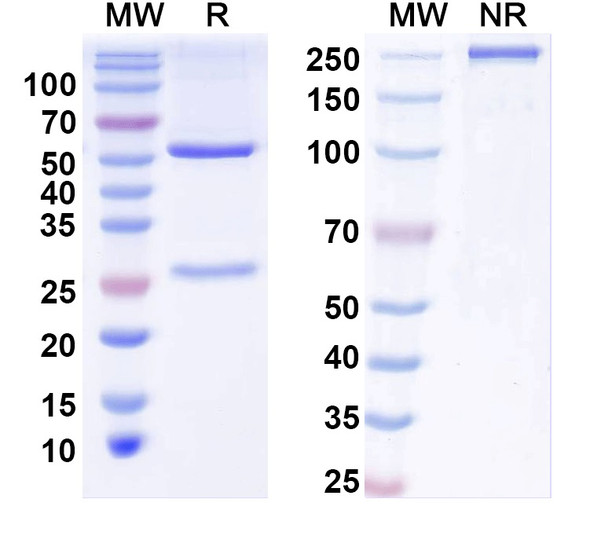 Anti-BBS5 Recombinant Monoclonal Antibody (N304B/115) - SDS-PAGE