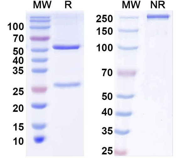 Anti-BBS5 Recombinant Monoclonal Antibody (N304B/115) - SDS-PAGE