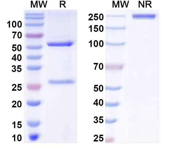 Anti-BBS5 Recombinant Monoclonal Antibody (N304B/40) - SDS-PAGE