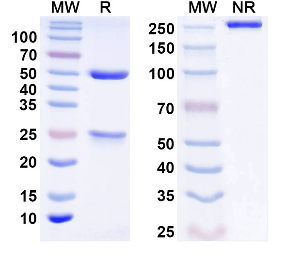 Anti-SVOP Recombinant Monoclonal Antibody (N356/9) - SDS-PAGE