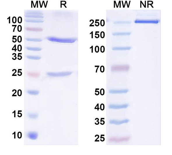 Anti-TrpV1 Recombinant Monoclonal Antibody (N221/17) - SDS-PAGE