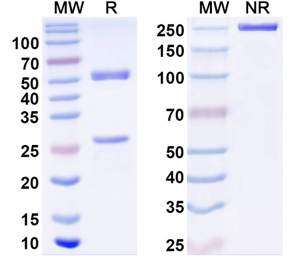 Anti-TrpV3 Recombinant Monoclonal Antibody (N15/39) - SDS-PAGE