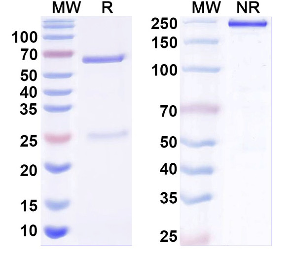 Anti-Neuroligin-2 Recombinant Monoclonal Antibody (L107/24) - SDS-PAGE