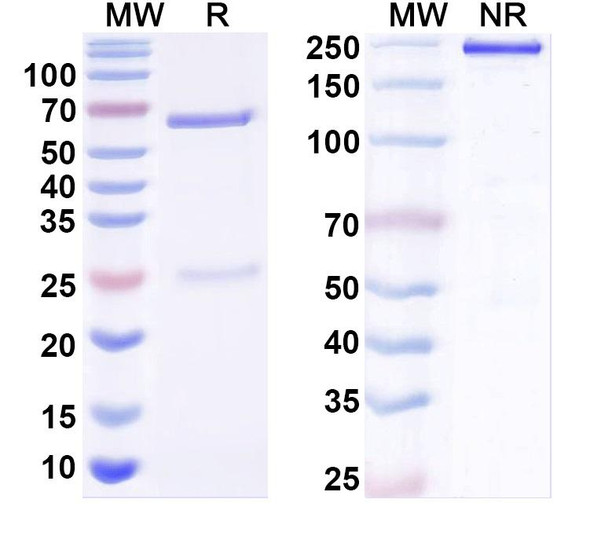Anti-Neuroligin-2 Recombinant Monoclonal Antibody (L107/24) - SDS-PAGE