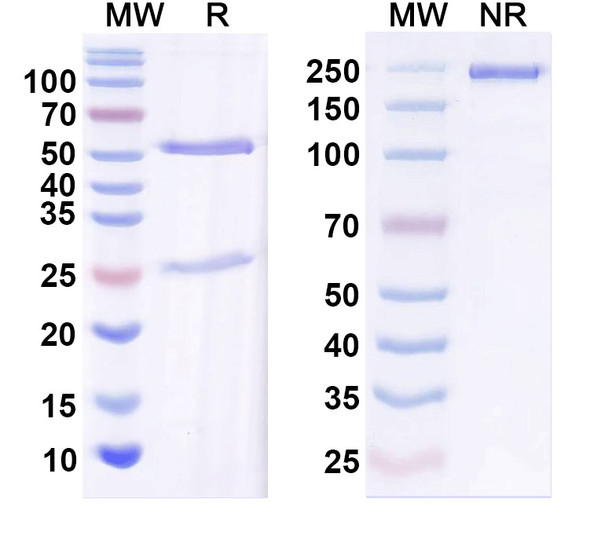 Anti-Beta1-spectrin Recombinant Monoclonal Antibody (N385/21) - SDS-PAGE