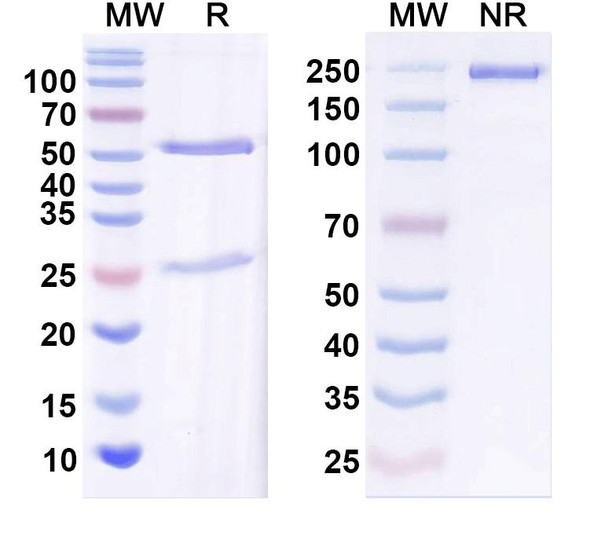 Anti-Beta1-spectrin Recombinant Monoclonal Antibody (N385/21) - SDS-PAGE